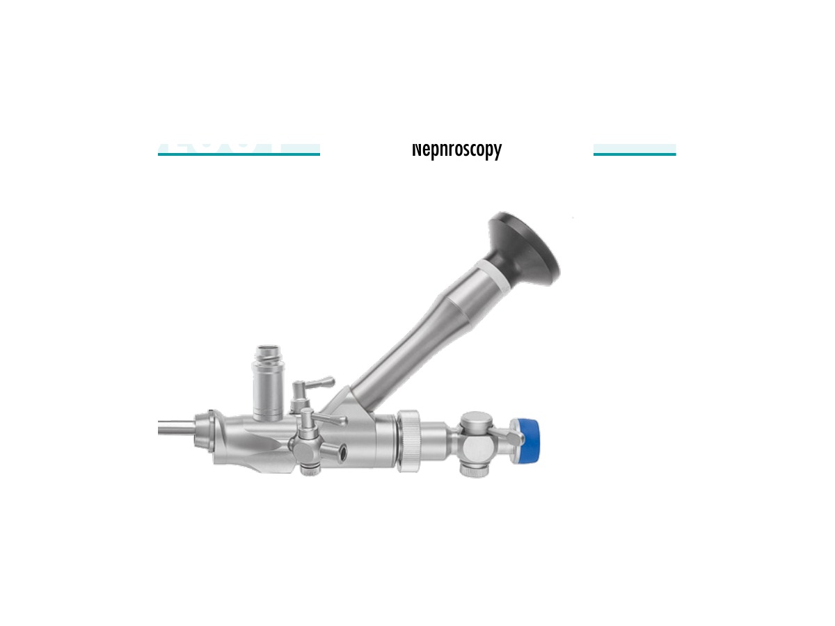 RZ Nefroscop percutan (PCNL)